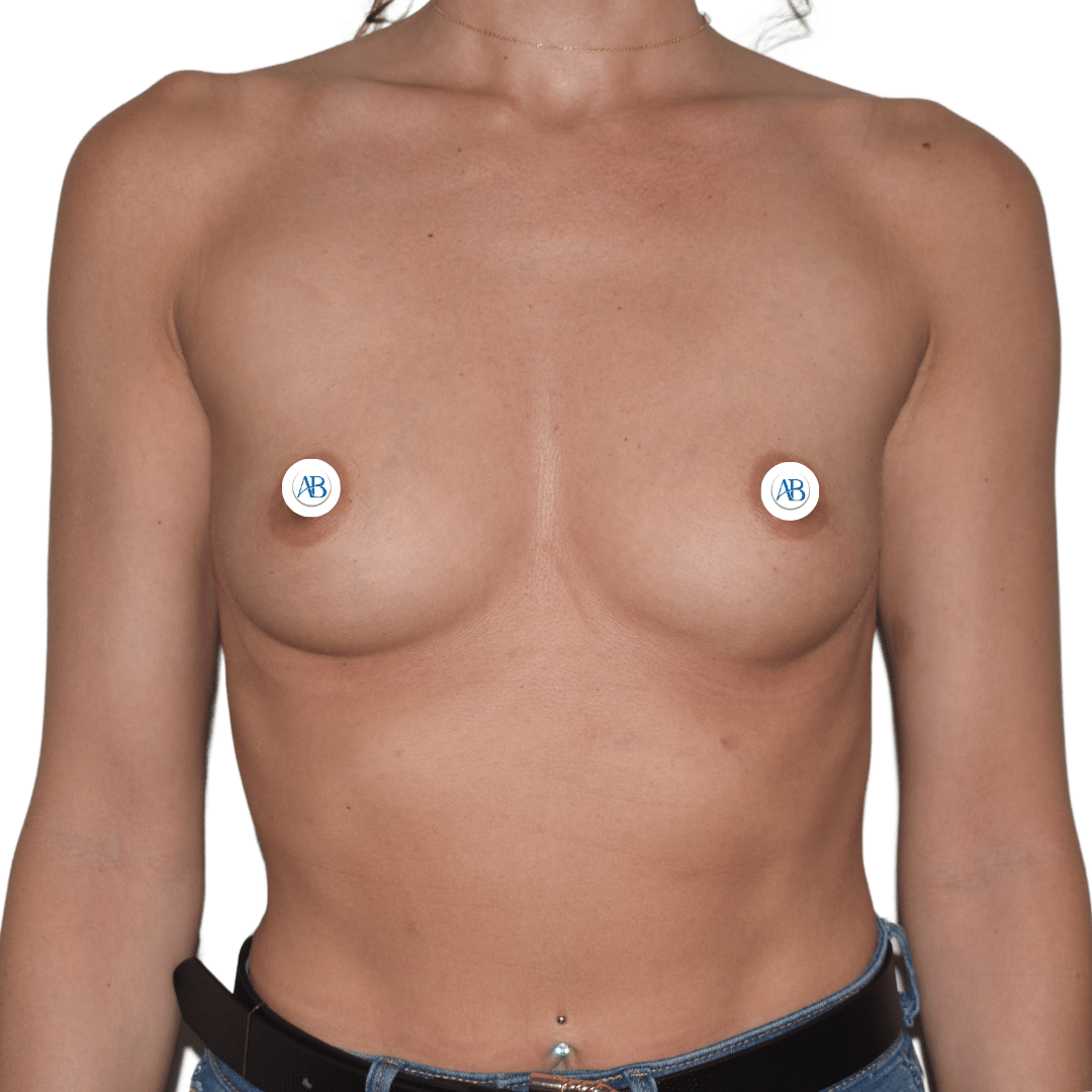 opiniones bilbao cirujano plastico